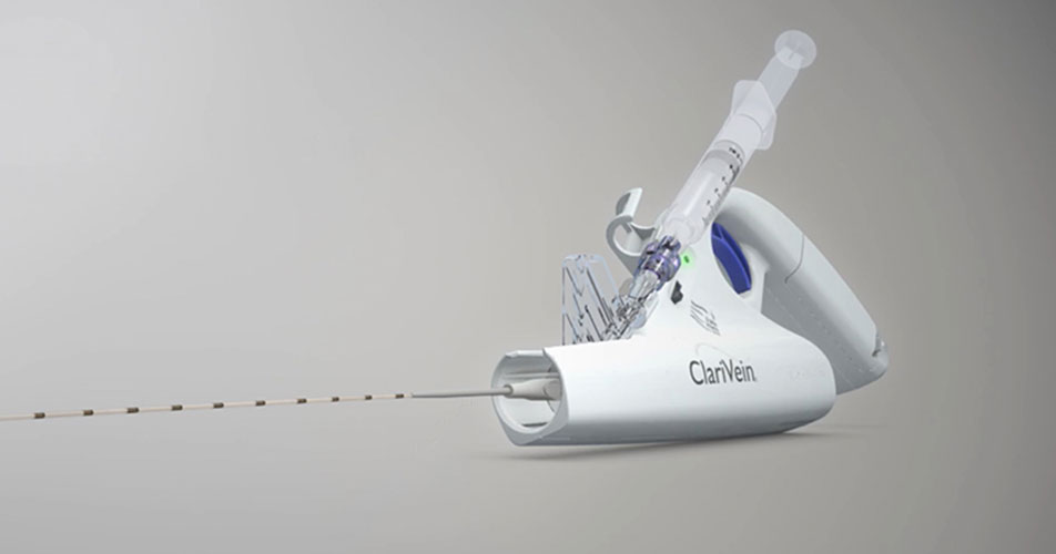 Tratamiento Endovascular